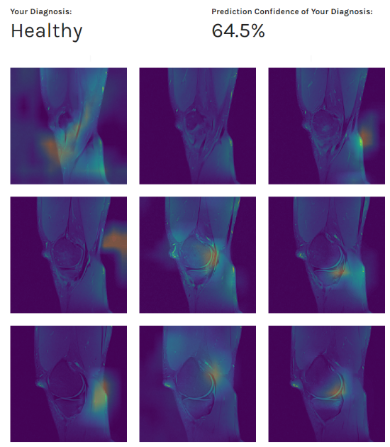 Example of patient’s diagnosis and MRI scans preview