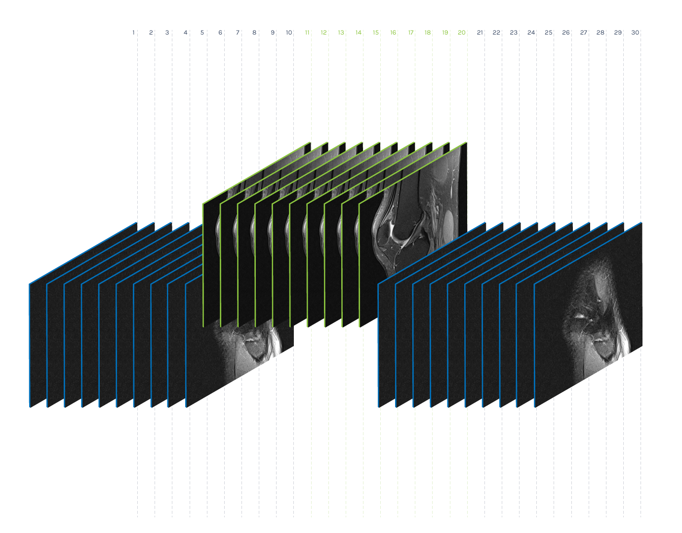 Volume Preprocessing